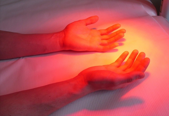 Read more about the article Światłoterapia – zabiegi